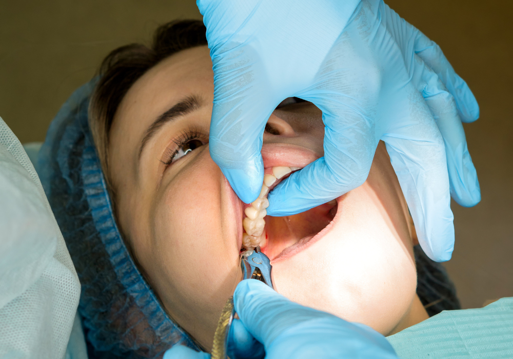 same-day tooth extractions Lexington Park